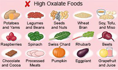 عکس درمان سنگ کلیه