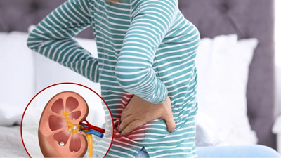 عکس درد کلیه