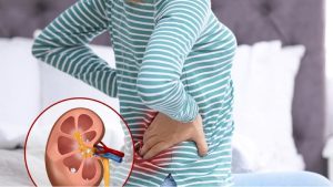 عکس درد کلیه